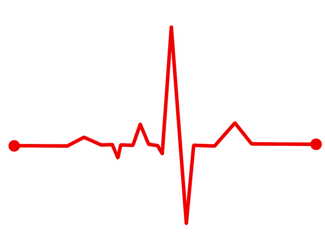 Covid-19 patients resting heart rate RHR affected for months after infection