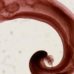 Lancet: Patients co-infected with intestinal parasites had lower odds of developing severe COVID-19