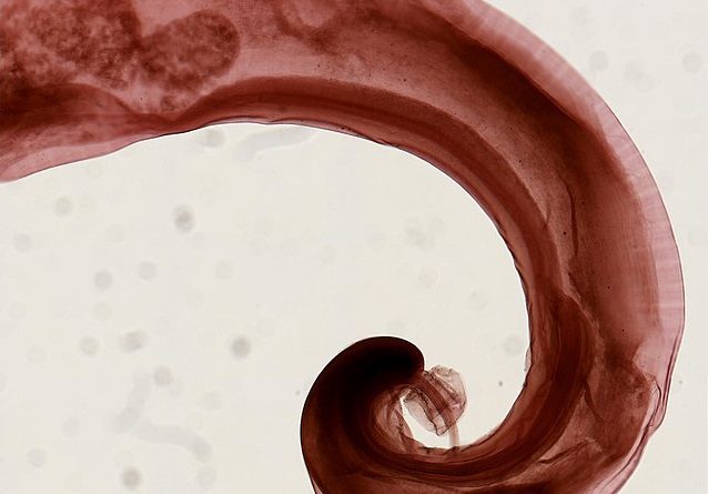 Trichuris trichiura intestinal parasite