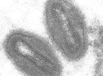 Electron Micrograph of Monkeypox virus