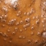 Monkeypox remains viable in aeorosol for up to 90 hours