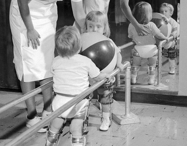 Polio in children 1951